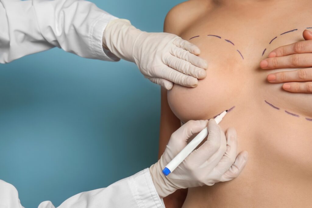 How long do breast implant scars take to heal？